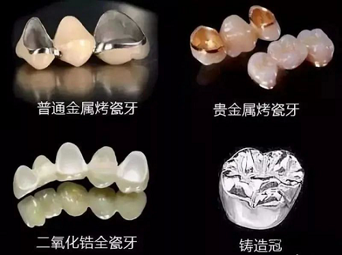 【身邊的先進陶瓷】義齒與氧化鋯陶瓷